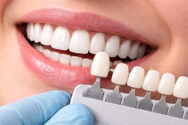کامپوزیت بهتر است یا لمینیت؟ مقایسه کامل مزایا، معایب، هزینه و دوام